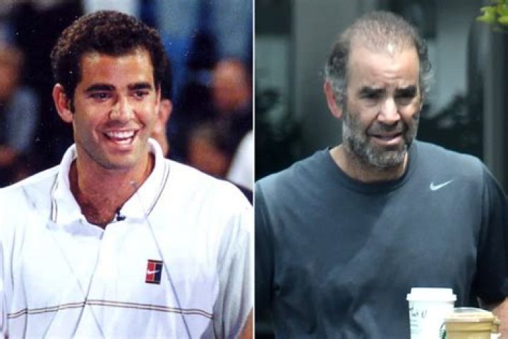 Christian Charles Sampras: The Maestro Of Tennis