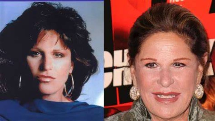 Fillers And Botox To Remain Youthful? |