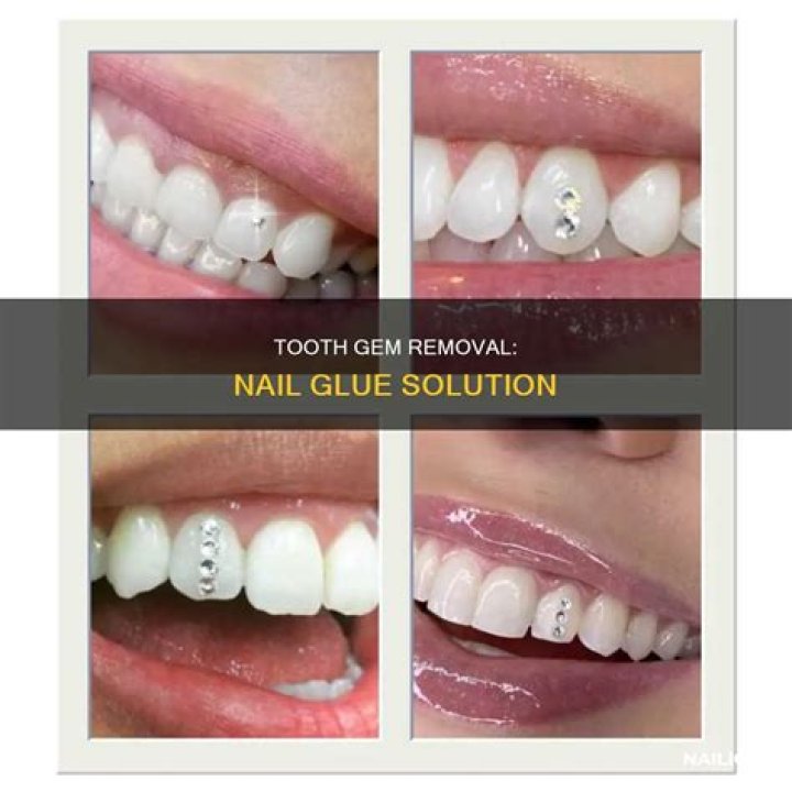 How To Get Nail Glue Off Teeth