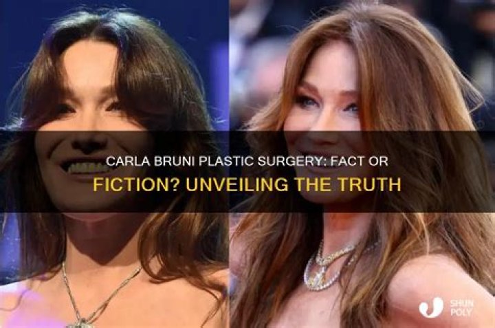 La La Anthony Plastic Surgery: Fact Or Fiction?