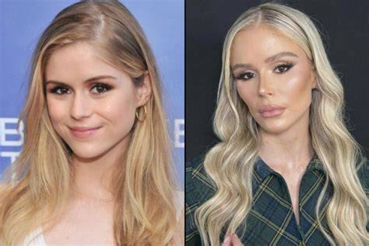 Mikhaila Peterson's Journey Before Plastic Surgery