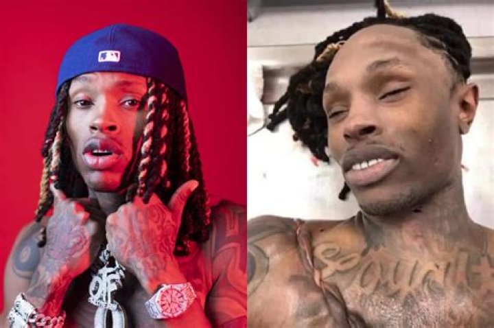 Unseen Details And Expert Analysis Of King Von's Autopsy Photo