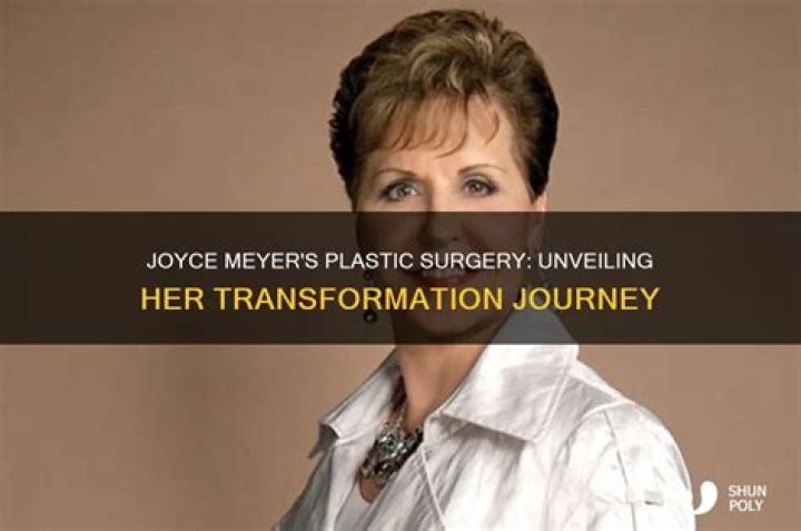 Unveiling Joyce Meyers' Transformation: Insights Before Plastic Surgery